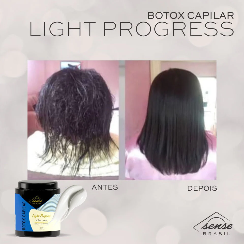 Senses Brazil - Botox - Light Progress

To convert from metric to US standards, please provide the specific measurements or units that need to be converted. - Image 4